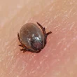 agyvelogyulladas