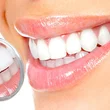 Complex periodontal disease screening at the Buda Health Center.