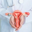 PCOS - Vegye komolyan a tüneteket!