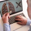 COPD világnap 2024