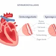 Szívburokgyulladás (pericarditis)