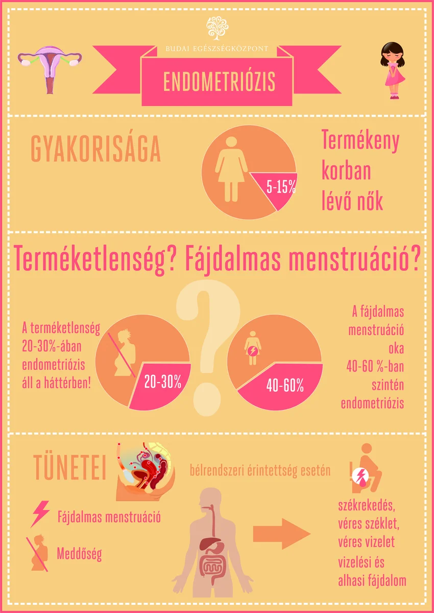 ENDOMETRIOZIS
