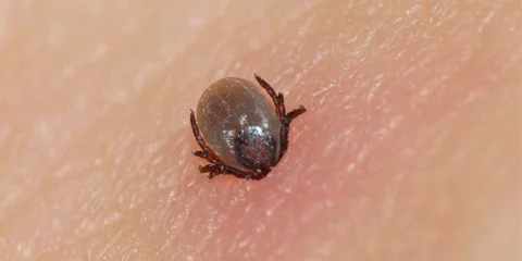 agyvelogyulladas