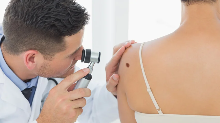 borgyogyaszat-anyajegy-melanoma-budai-egeszsegkozpont