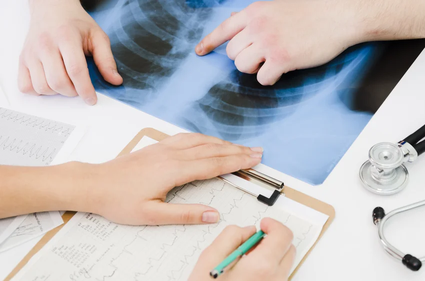 A telefonos pulmonológiai konzultációt elsősorban azon pácienseink számára ajánljuk, akik már jártak pulmonológiai vizsgálaton intézetünkben.