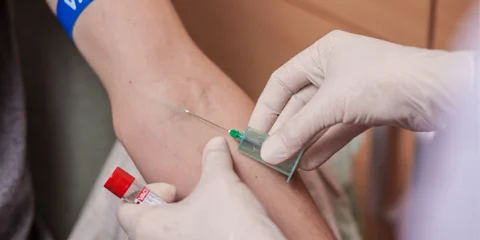 Blood allergy test