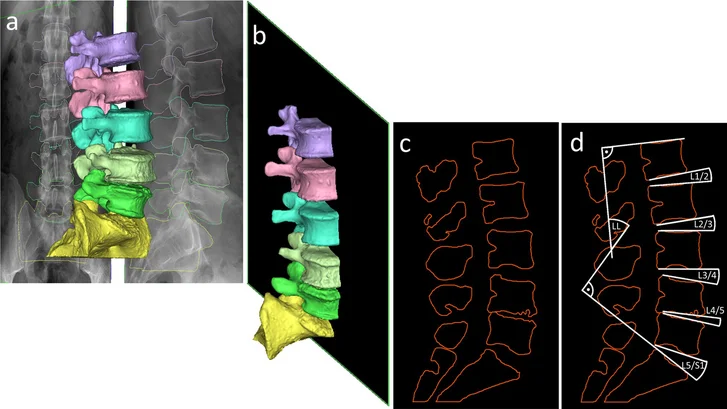 Beszélgetés Dr. Éltes Péterrel, az In Silico Biomechanikai Laboratórium vezetőjével