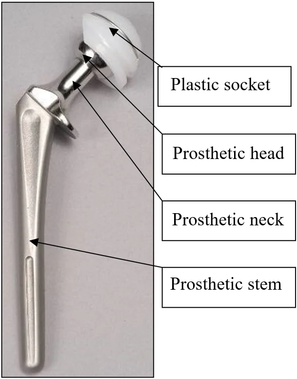Hip replacement surgery - Buda Health Center