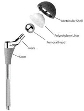 Hip replacement surgery - Buda Health Center