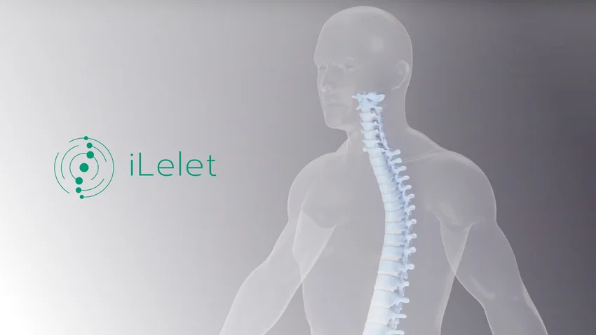 Tesztelje Ön is új fejlesztésünket, az iLeletet!