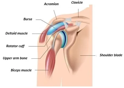 Shoulder (subacromial) decompression