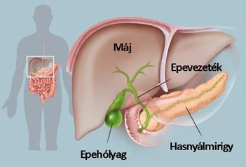 Epehólyagműtét laparoszkóppal