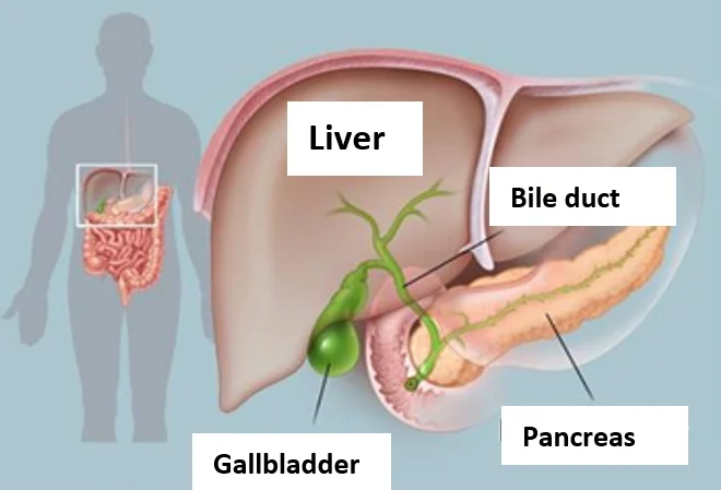 Gallbladder surgery by laparoscopy