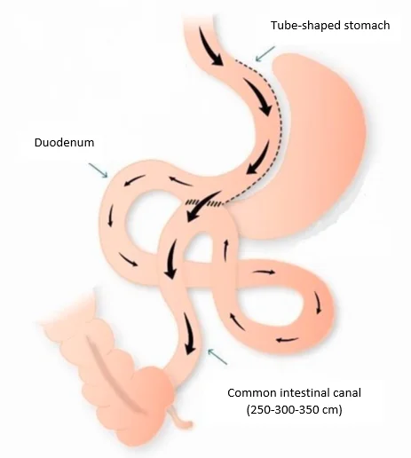 Weight loss surgery - Buda Health Center