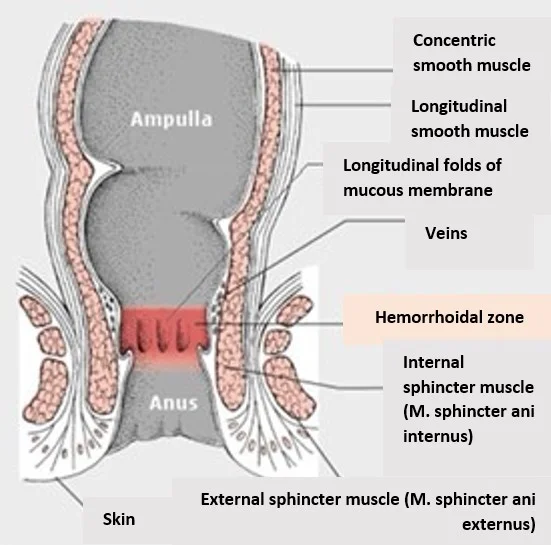 Treatment of a chronic rectal wound with ultrasound guided Botulinum toxin injection