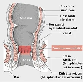 Krónikus végbélseb ellátás UH vezérelt Botulinum toxin injekcióval