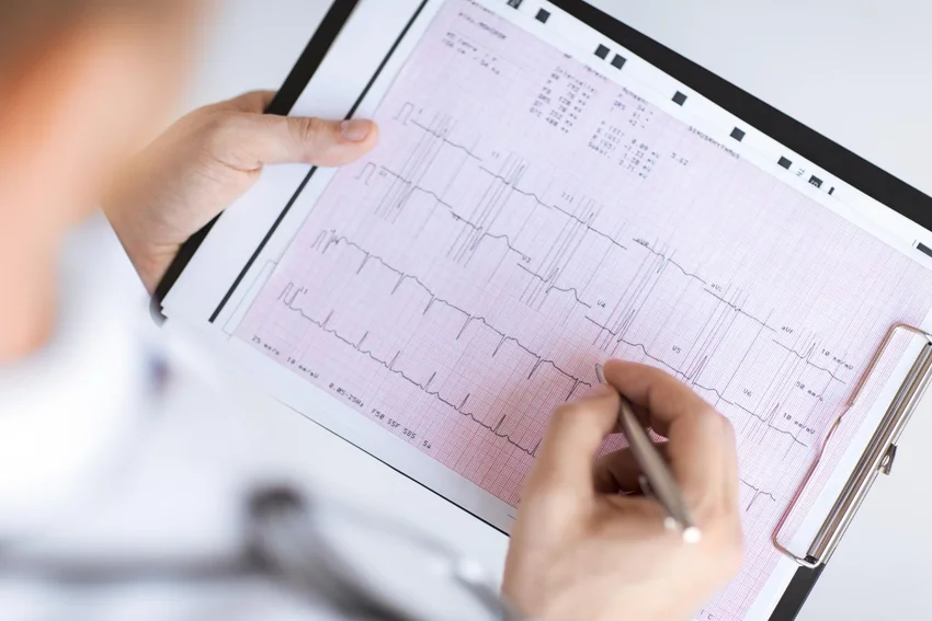 Terheléses EKG