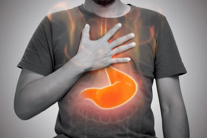 Reflux: megbízható válaszok a legégetőbb kérdésekre