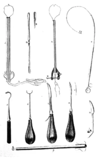 Orrpolypózis és sírgyalázás - a négyszer eltemetett Joseph Haydn története