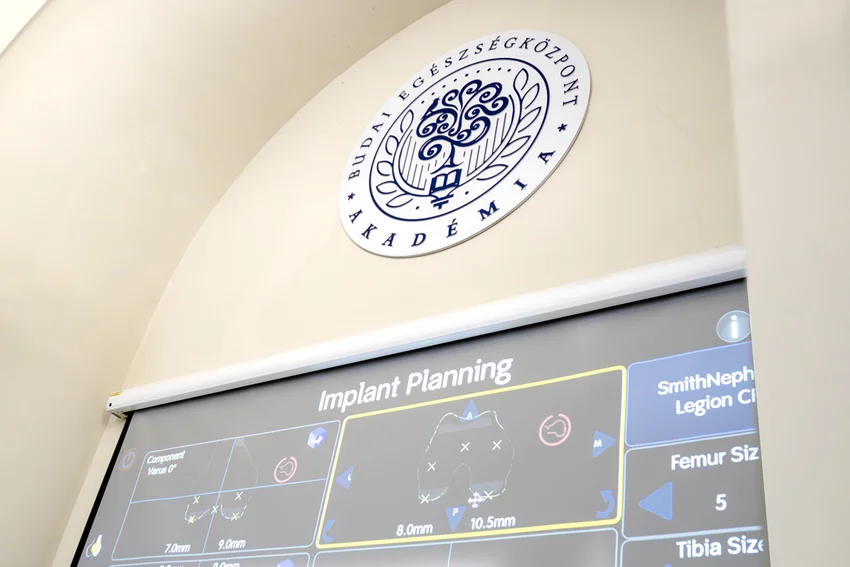 Robotasszisztált térdprotézis-sebészet: több mint egy év tapasztalatait adtuk tovább a BEK Akadémián