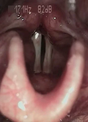 A hang változása komoly jelzés is lehet – Interjú Dr. Burián Andrással