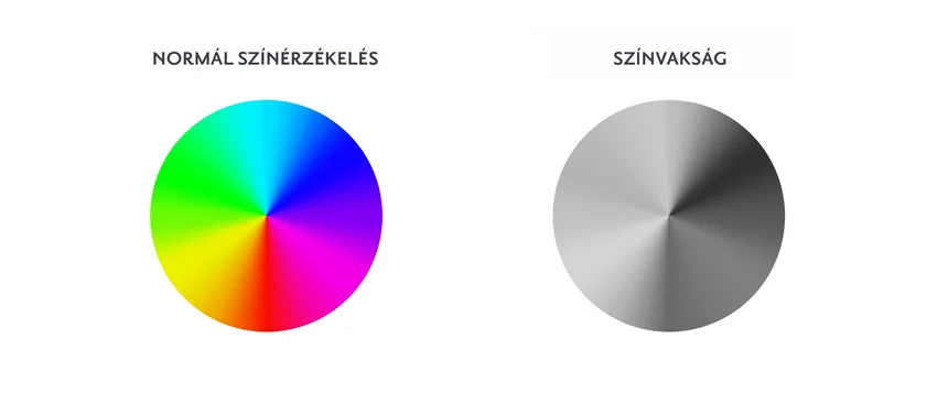 Teljes színvakság (achromatopszia)