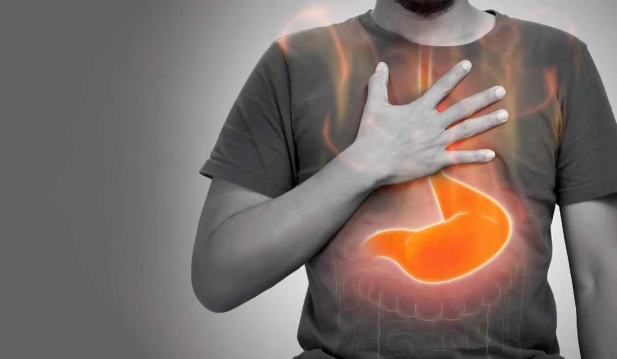 Reflux: megbízható válaszok a legégetőbb kérdésekre