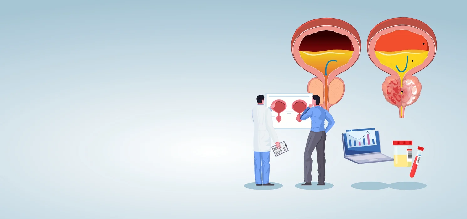 Prosztatamegnagyobbodás infografika